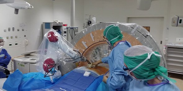 Opération de chirurgie sur une hernie discale avec le robot Rosa Spine de Zimmer Biomet robotics.