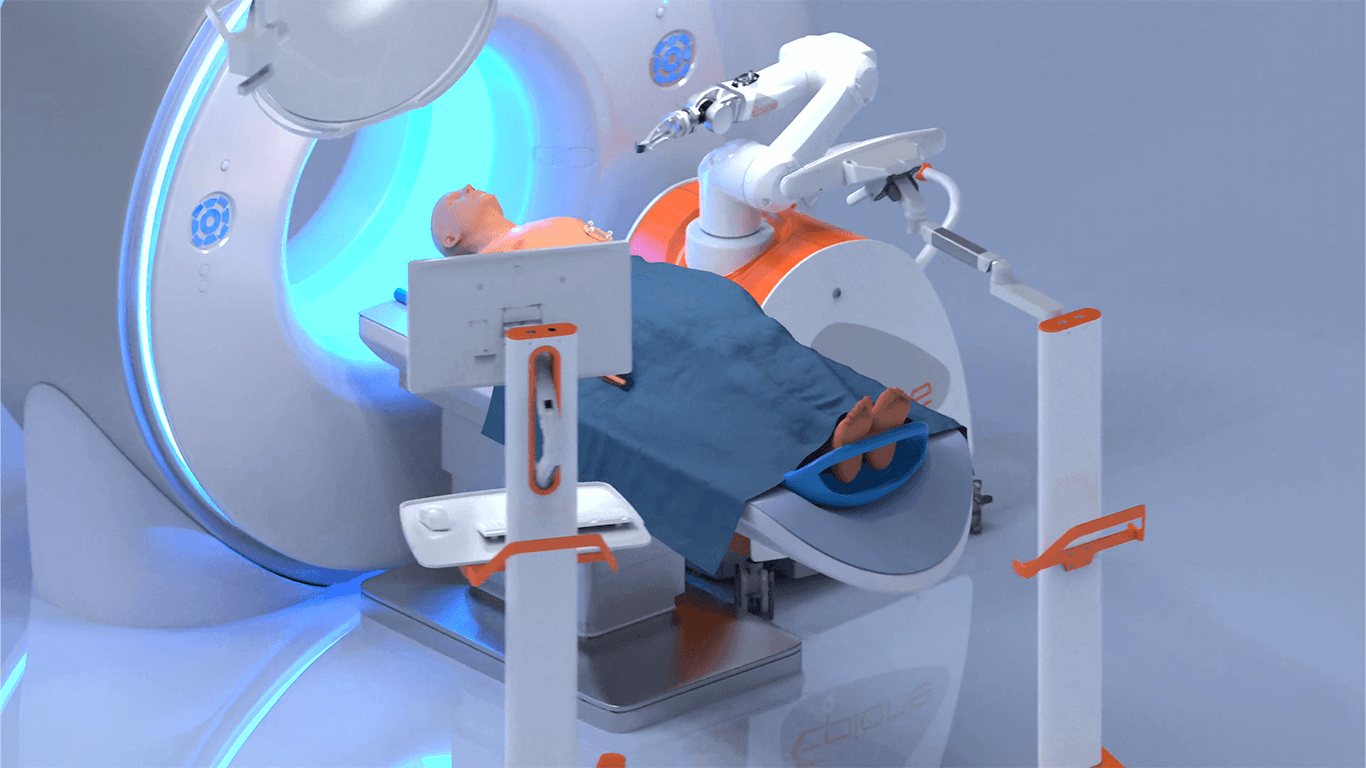 robot epione quantum surgical traitement cancer